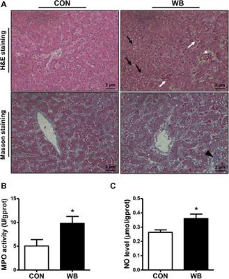 Hepatic Oxidative Stress, Apoptosis, and Inflammation in Broiler Chickens With Wooden Breast Myopathy